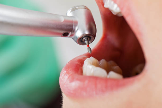 Best Root Canal Emergency Dentist  in Clarinda, IA